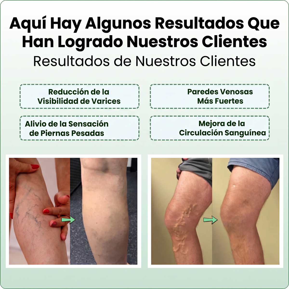 Rejuvenecedor de Venas Azul Advanced